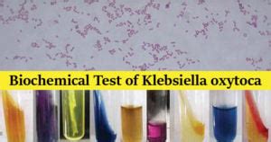 klebsiella biochemical test|klebsiella oxytoca oxidase test.